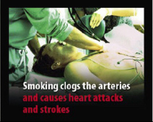 EU 2004 Health Effects arteries - lived experience, clogged arteries, heart attack, stroke